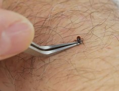 Bug Bite Thing® Tick Remover